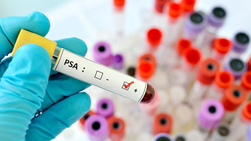 Drug Discovery Toxicology Drug Discovery Toxicology